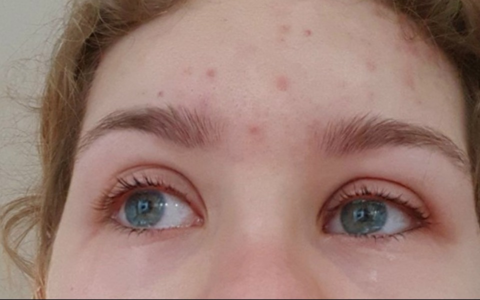 
        Zbiórka Moje zdrowie psychiczne - zdjęcie główne
    