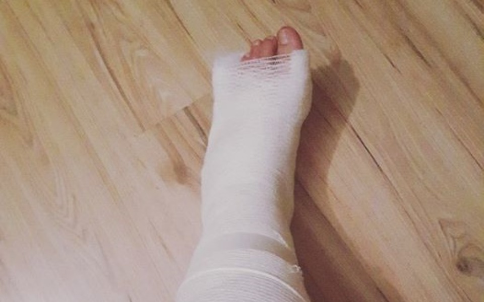 
        Zabandażowana stopa, widoczna kontuzja.
    