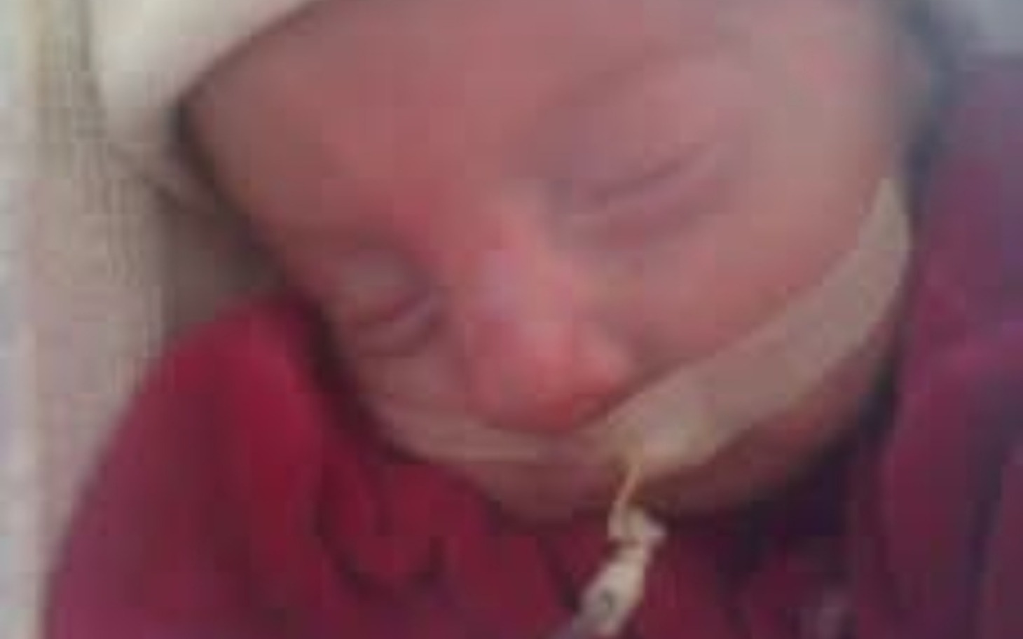 
        Noworodek w inkubatorze, potrzebujący wsparcia.
    