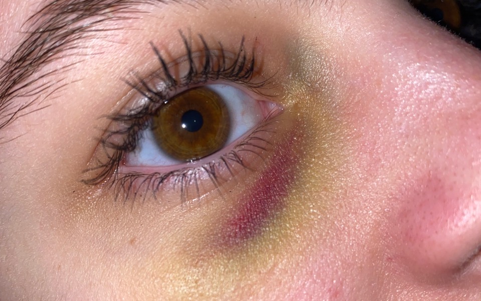 
        Zbiórka Pomoc mamie na rozwód - zdjęcie główne
    