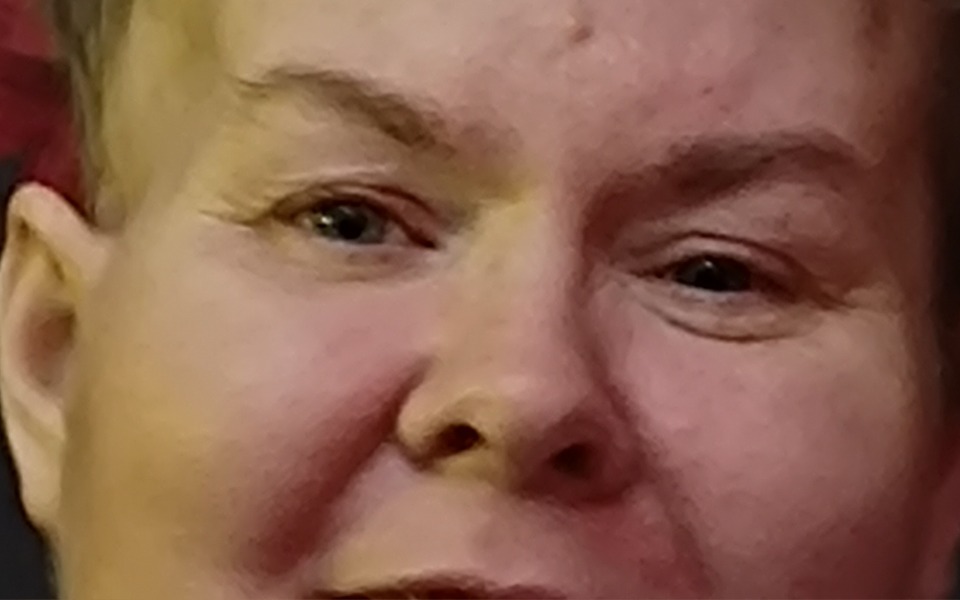 
        Zbiórka Rehabilitacja ręki i nogi - udar - zdjęcie główne
    