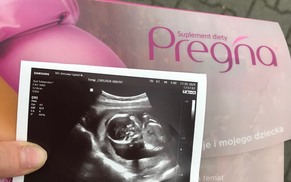 
        Zbiórka Na wyprawkę na maluszka - zdjęcie główne
    