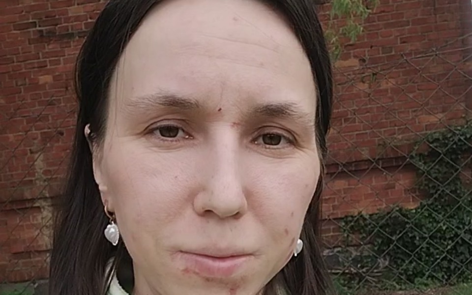 
        Zbiórka Potrzebuje na rachunki czynż - zdjęcie główne
    