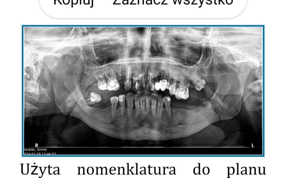 
        Zbiórka Proszę o pomoc w odbudowie kości - zdjęcie główne
    