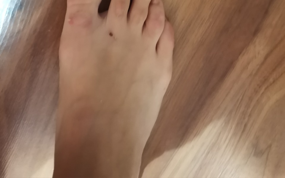 
        Zbiórka Żylaki, zator - zdjęcie główne
    