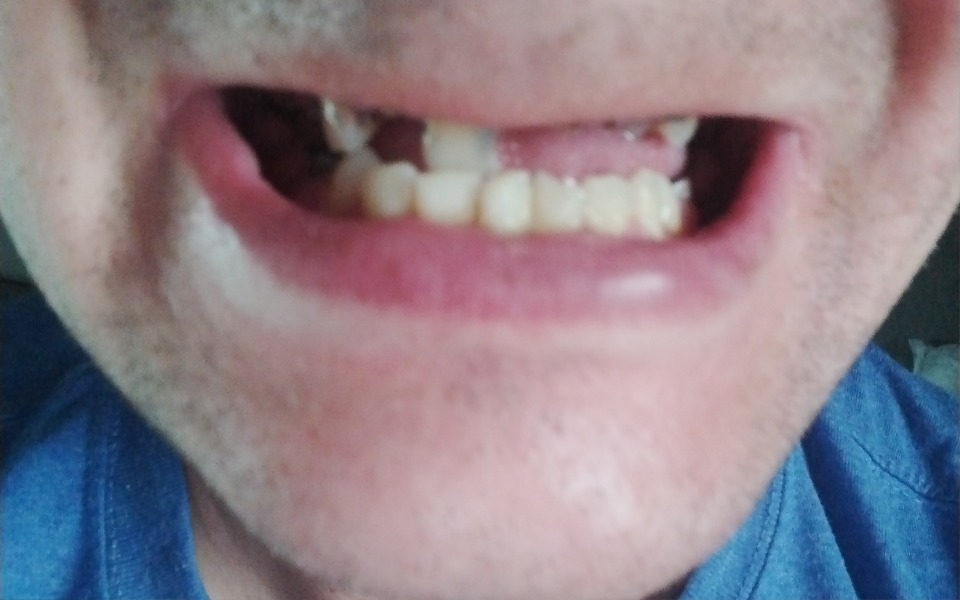 
        Zbiórka Na nowy uśmiech . - zdjęcie główne
    