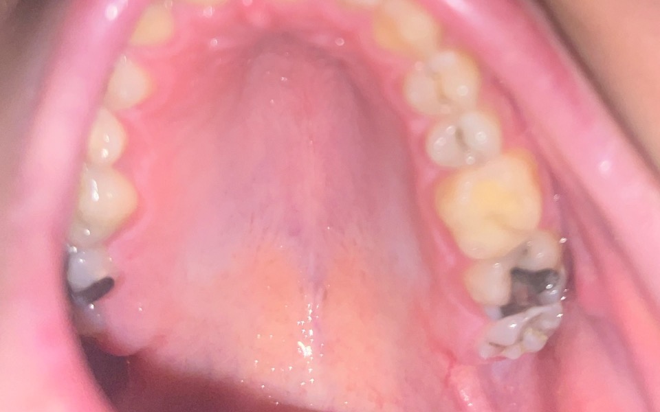 
        Zbiórka Dentysta - proszę o pomoc - zdjęcie główne
    