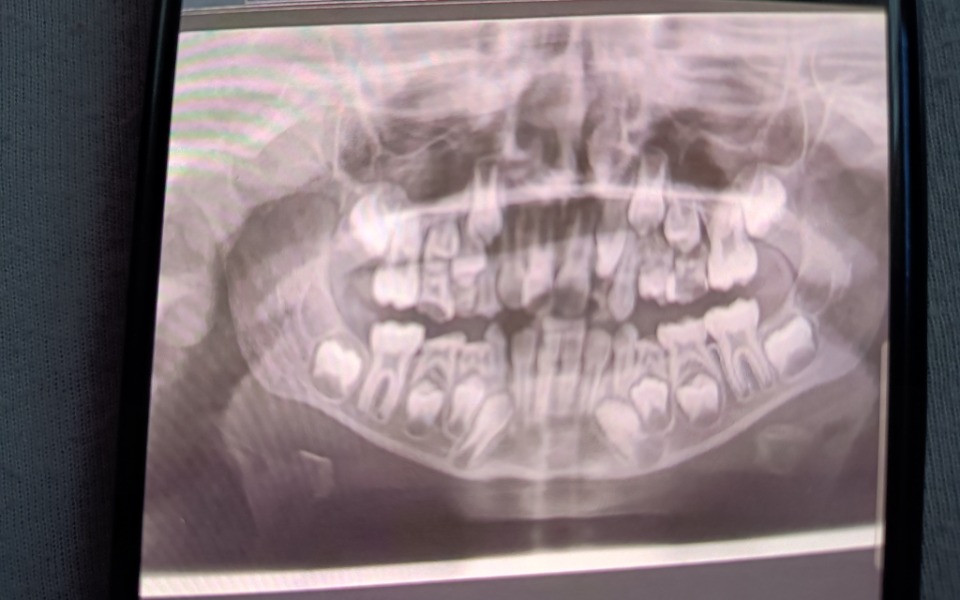 
        Zbiórka Zbiórka na prywatne wizyty córki - zdjęcie główne
    