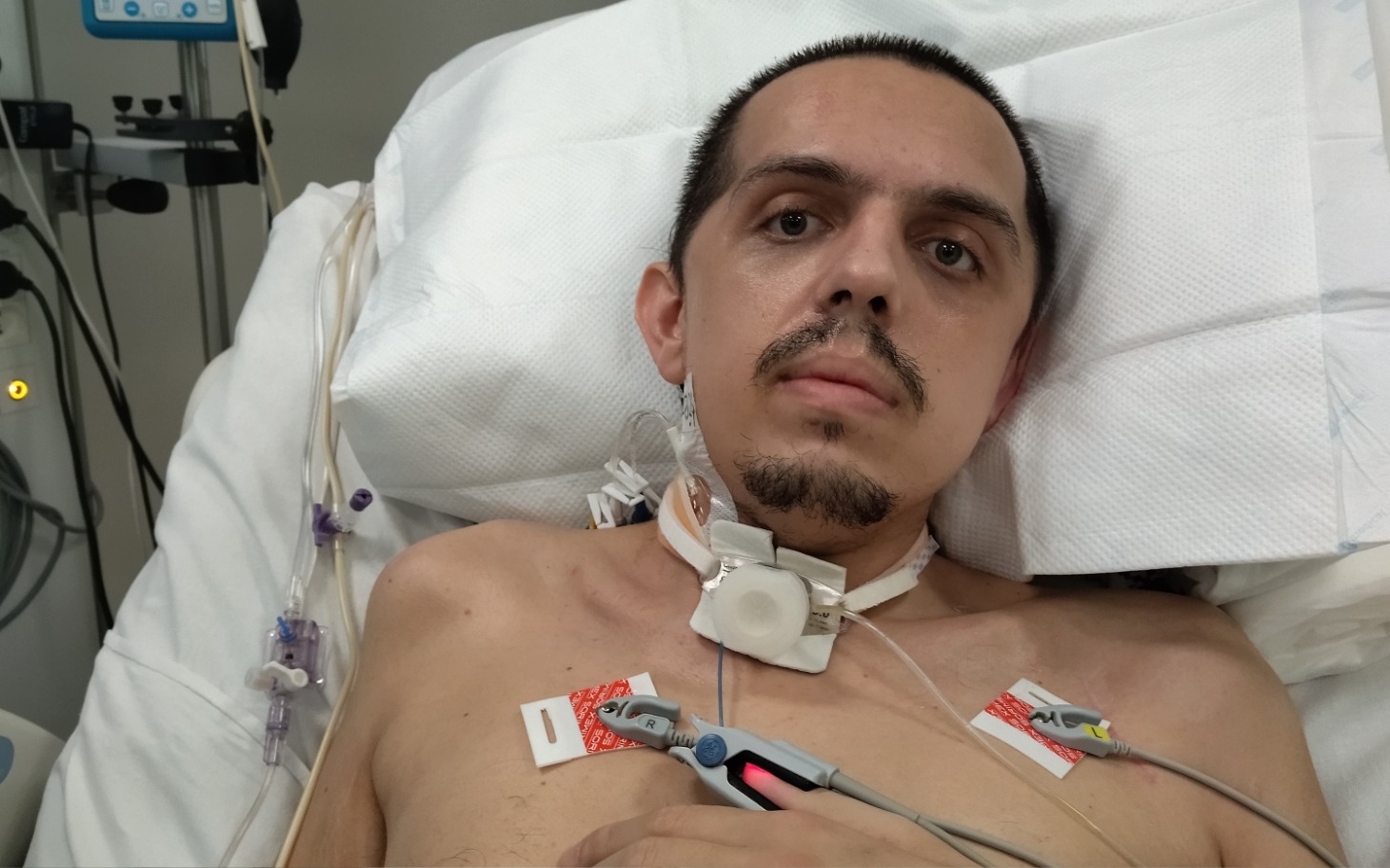Mężczyzna leżący w szpitalu, z monitorami i rurkami medycznymi.