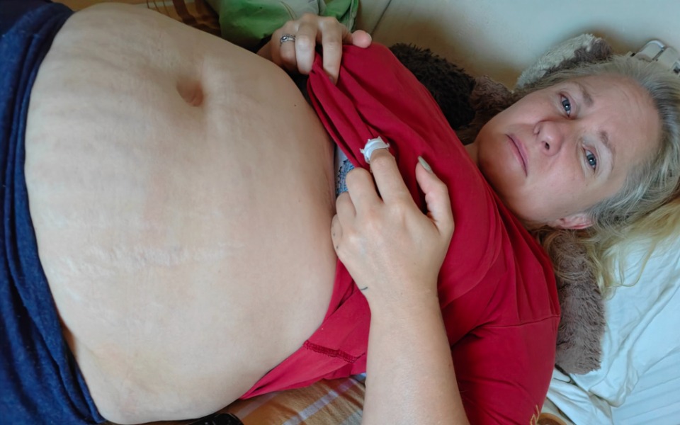 
        Zbiórka Leczenie endometrioza - zdjęcie główne
    