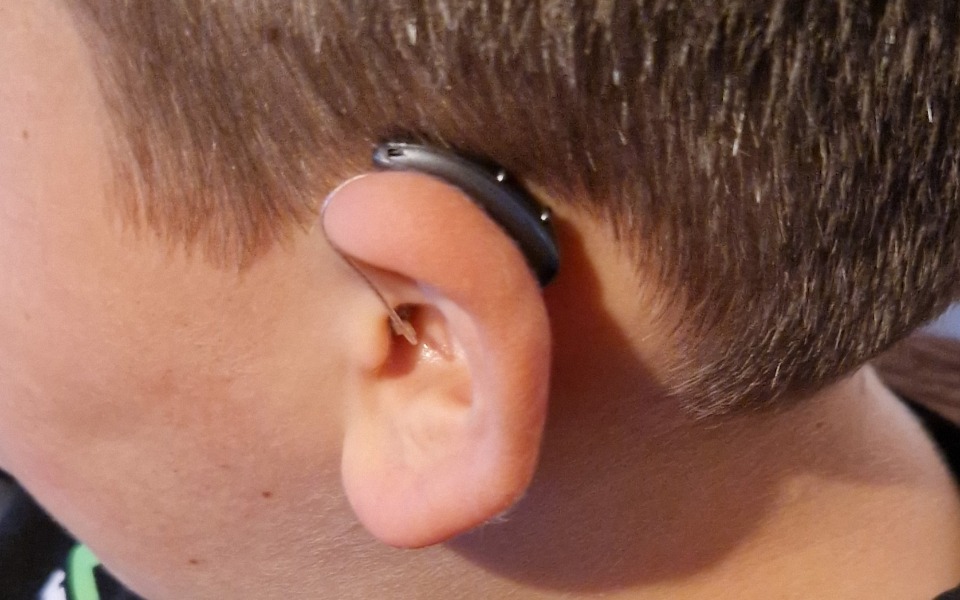 
        Zbiórka Aparat słuchowy SIGNIA - zdjęcie główne
    