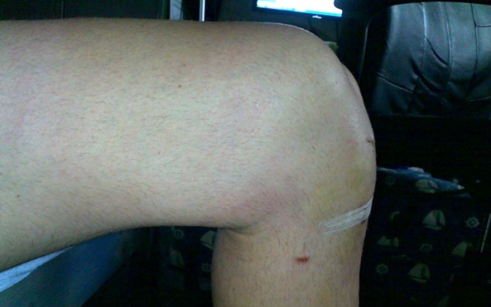 
        Zbiórka Operacja nóg ważny jest czas - zdjęcie główne
    