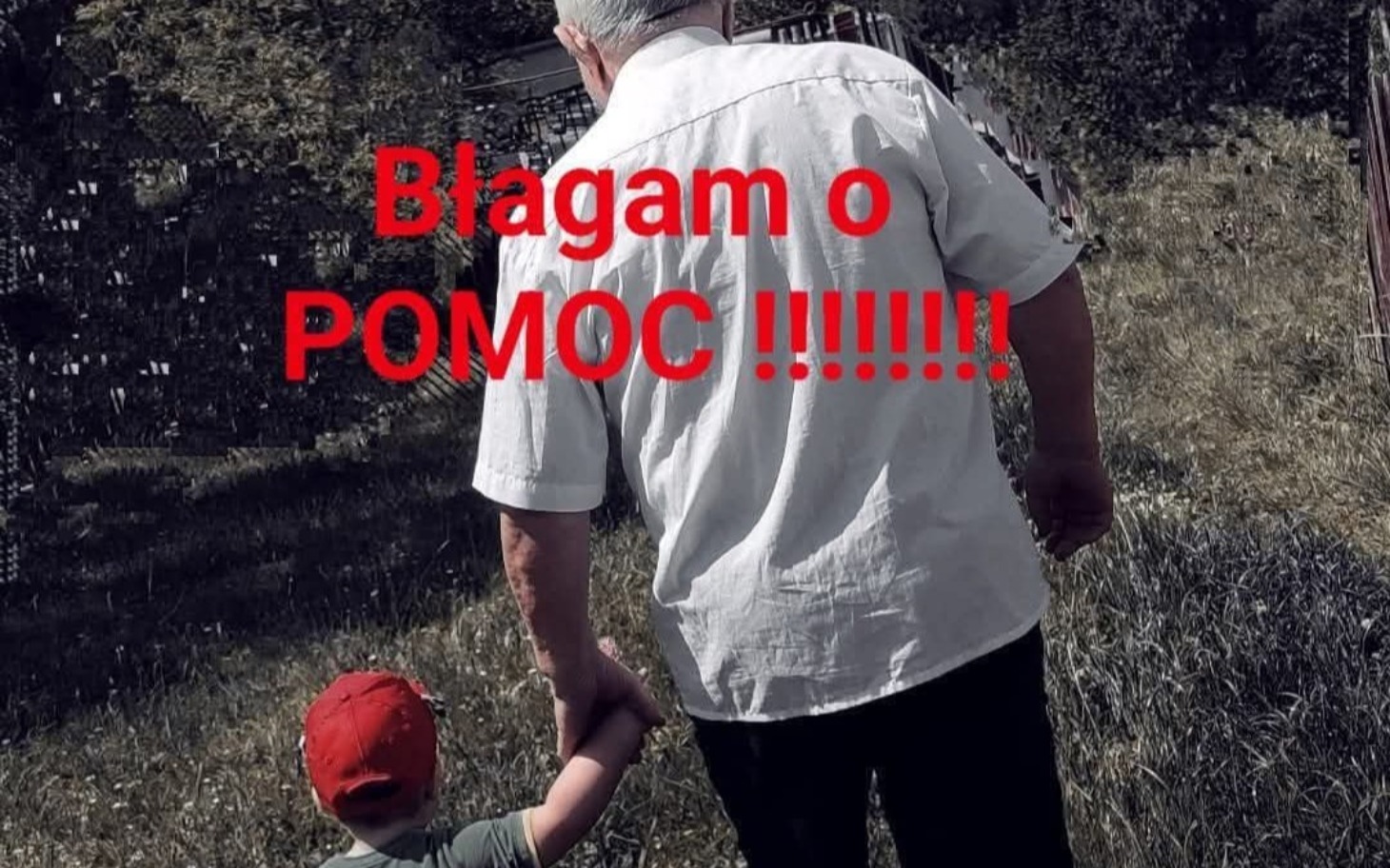 
        Zraniona noga, widok na oparzenia i rany.
    