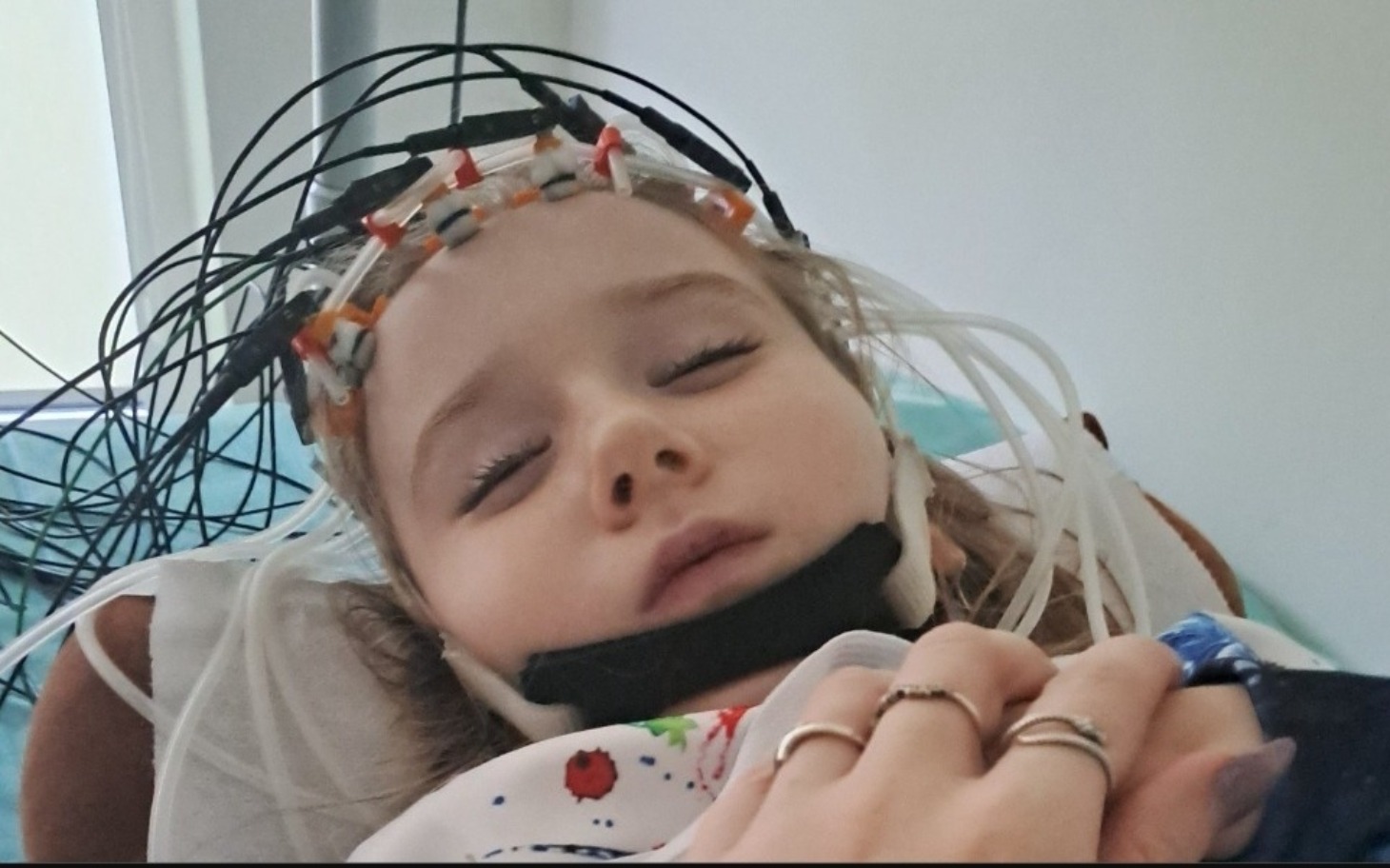 
        Małe dziecko w szpitalu z elektrodami na głowie, śpi spokojnie.
    