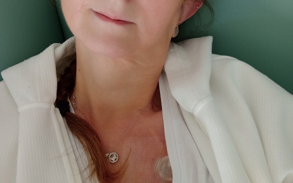 
        Kobieta w szpitalu, widok na jej szyję z cewnikiem.
    