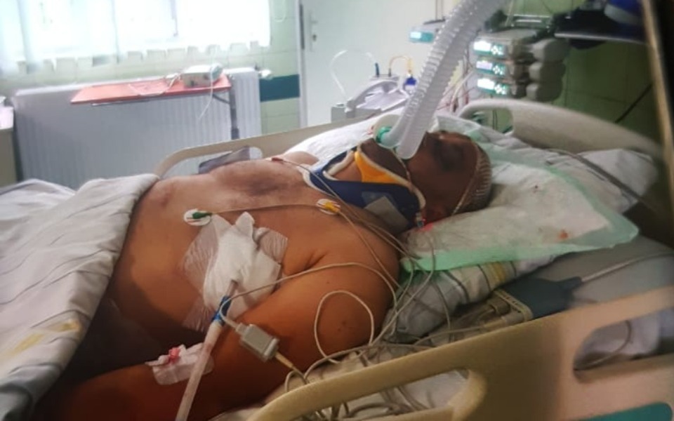 
        Mężczyzna w szpitalu z podłączonymi urządzeniami medycznymi.
    