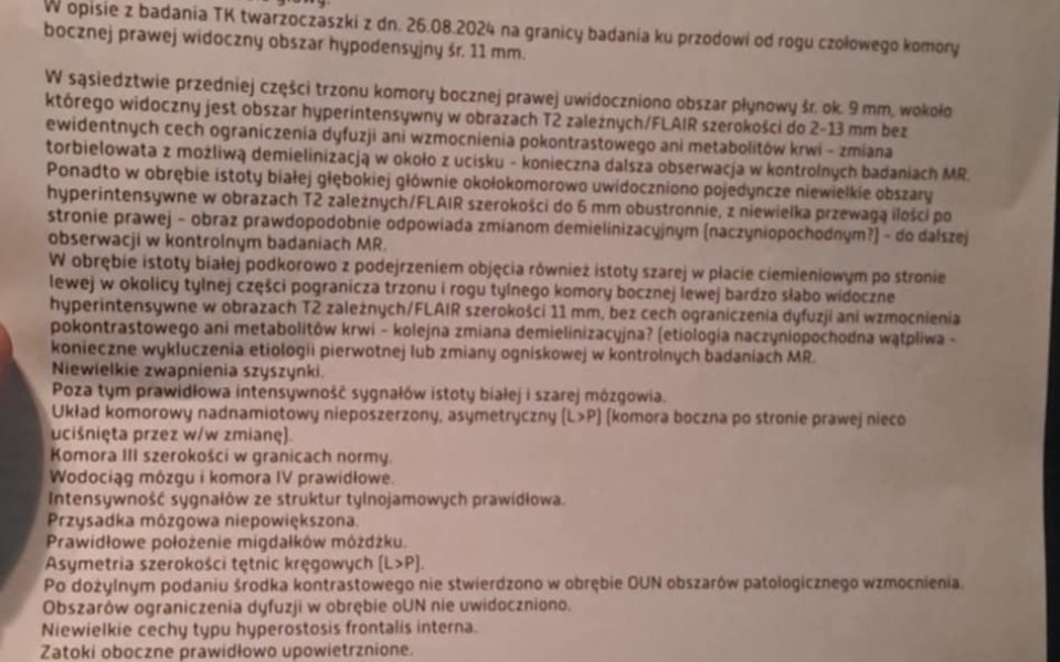 
        Zbiórka Na leczenie raka mózgu - zdjęcie główne
    