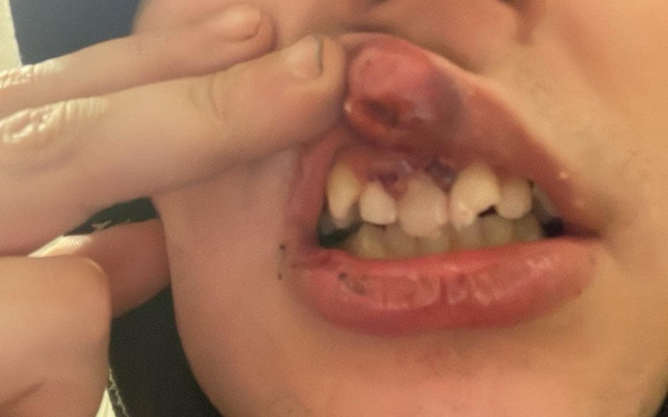 
        Zbiórka Naprawa zębów po napaści - zdjęcie główne
    