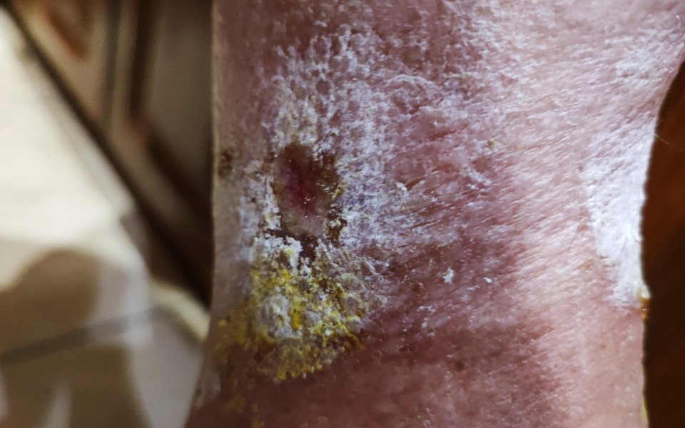 
        Zbiórka Schorowana Barbara - zdjęcie główne
    