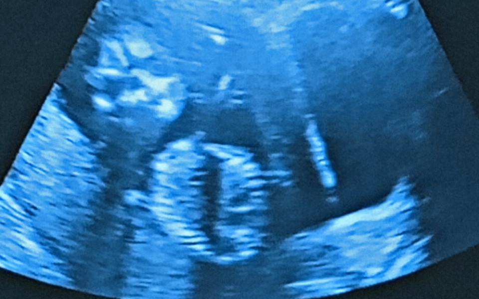 
        Zbiórka Kobieta w ciąży potrzebuje pomoc - zdjęcie główne
    