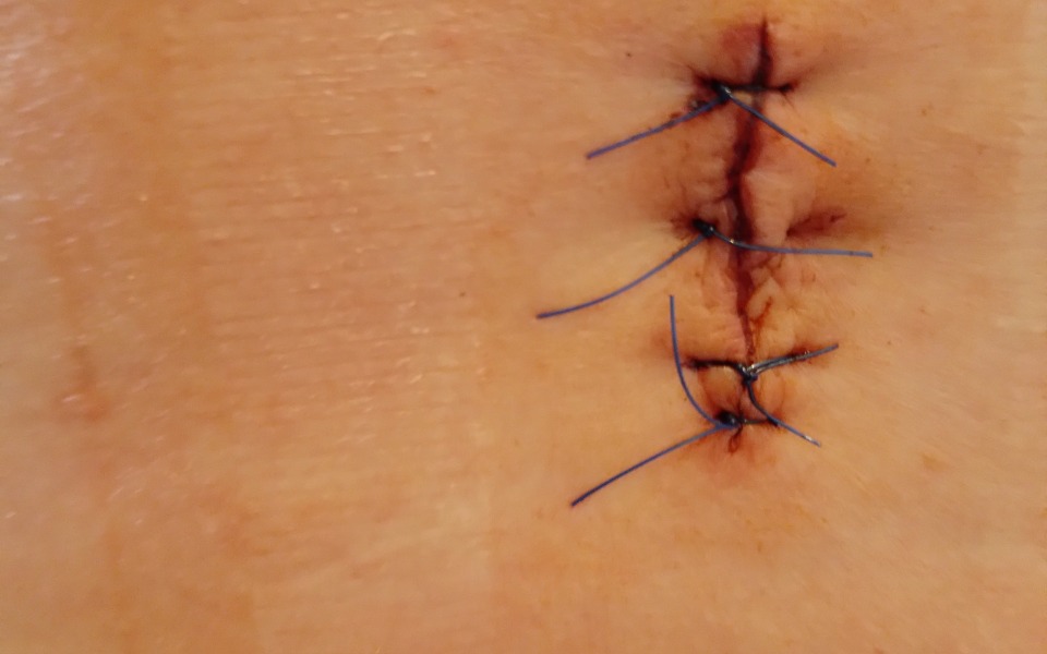 
        Zbiórka Zbiorka na leczenie i rehabilita - zdjęcie główne
    