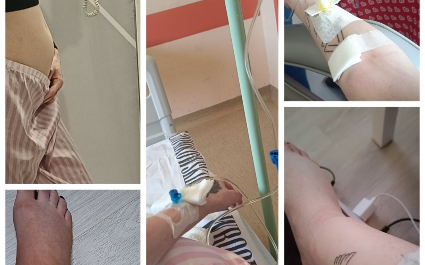 
        Kolaż zdjęć przedstawiających ręce z opatrunkami i tatuażami.
    