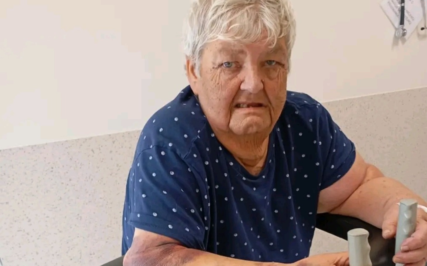 
        Starsza kobieta siedząca na wózku, z poważnym wyrazem twarzy.
    