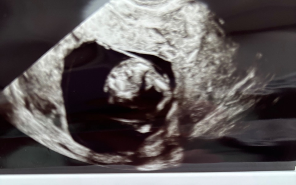 
        Zdjęcie ultrasonograficzne, przyszły członek rodziny.
    