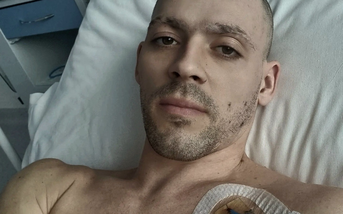
        Mężczyzna leżący w szpitalu, z widoczną opatrunkiem na klatce piersiowej.
    