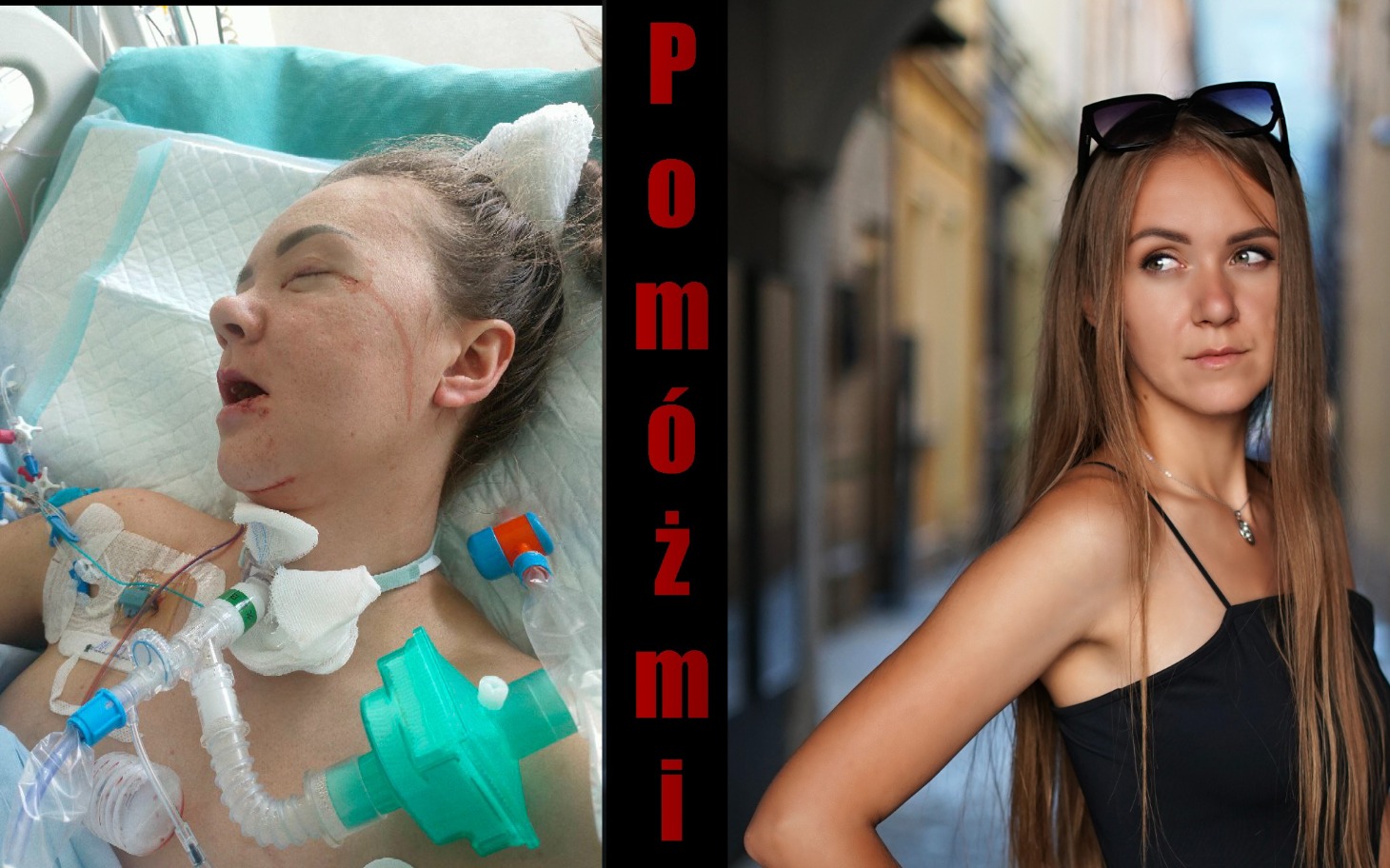 
        Kobieta w szpitalu, walcząca o zdrowie po poważnym wypadku.
    