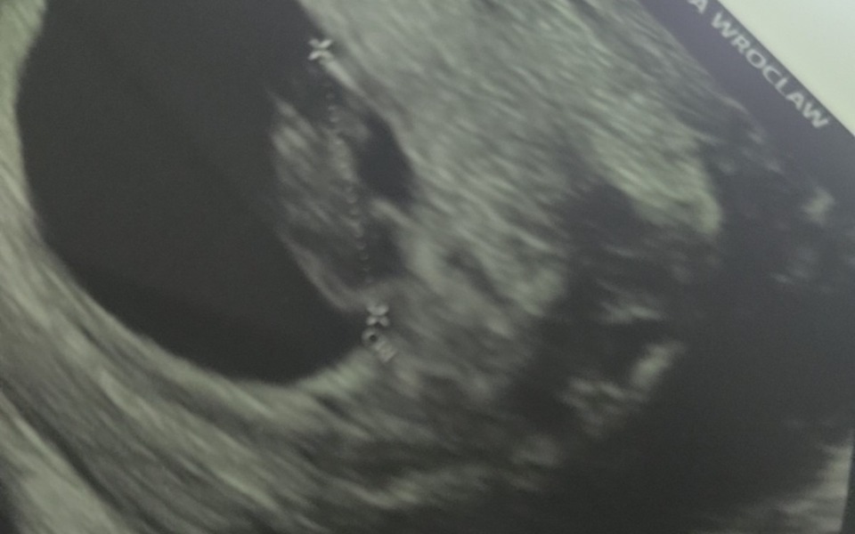 
        Ultrasonografia przedstawiająca obraz wewnętrzny.
    