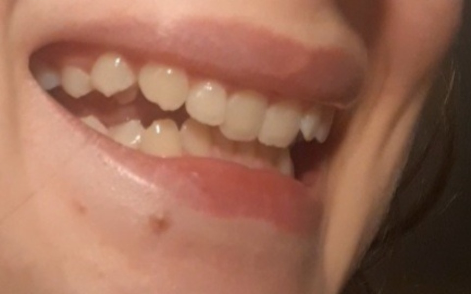 
        Uśmiechnięta twarz z widocznymi zębami.
    