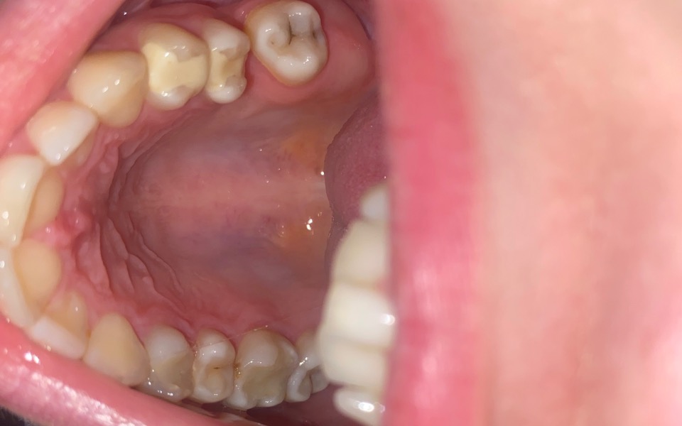 
        Widok wnętrza jamy ustnej z zębami.
    