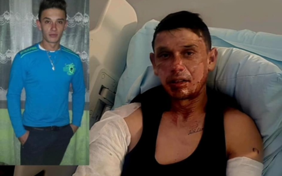 Mężczyzna z obrażeniami na twarzy w szpitalu.