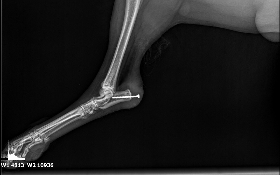 
        Rentgen pokazujący staw łokciowy z wkrętem.
    