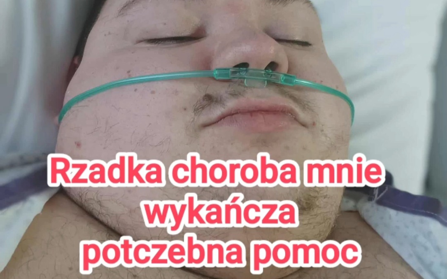 
        Mężczyzna z rzadką chorobą, potrzebujący wsparcia.
    