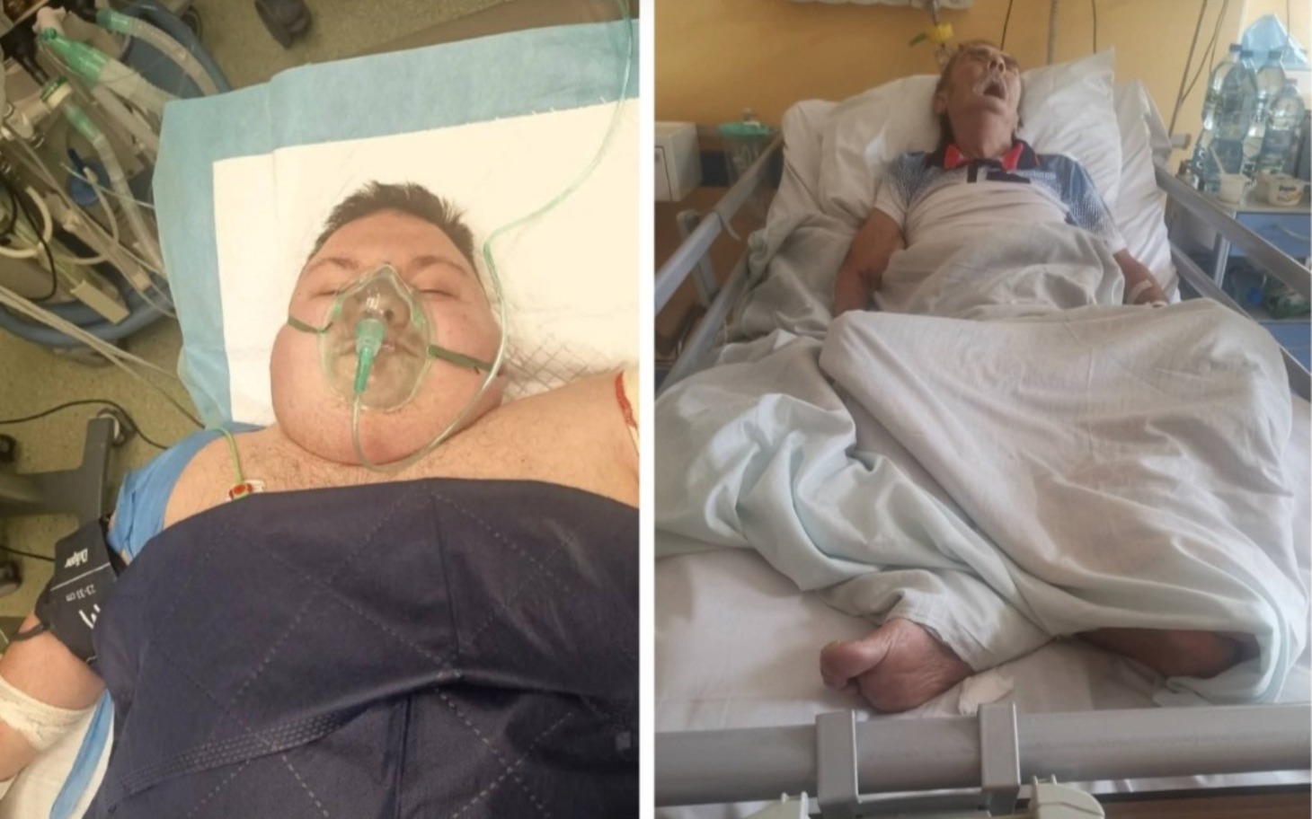 
        Starszy mężczyzna leżący w łóżku szpitalnym, w trudnej sytuacji zdrowotnej.
    