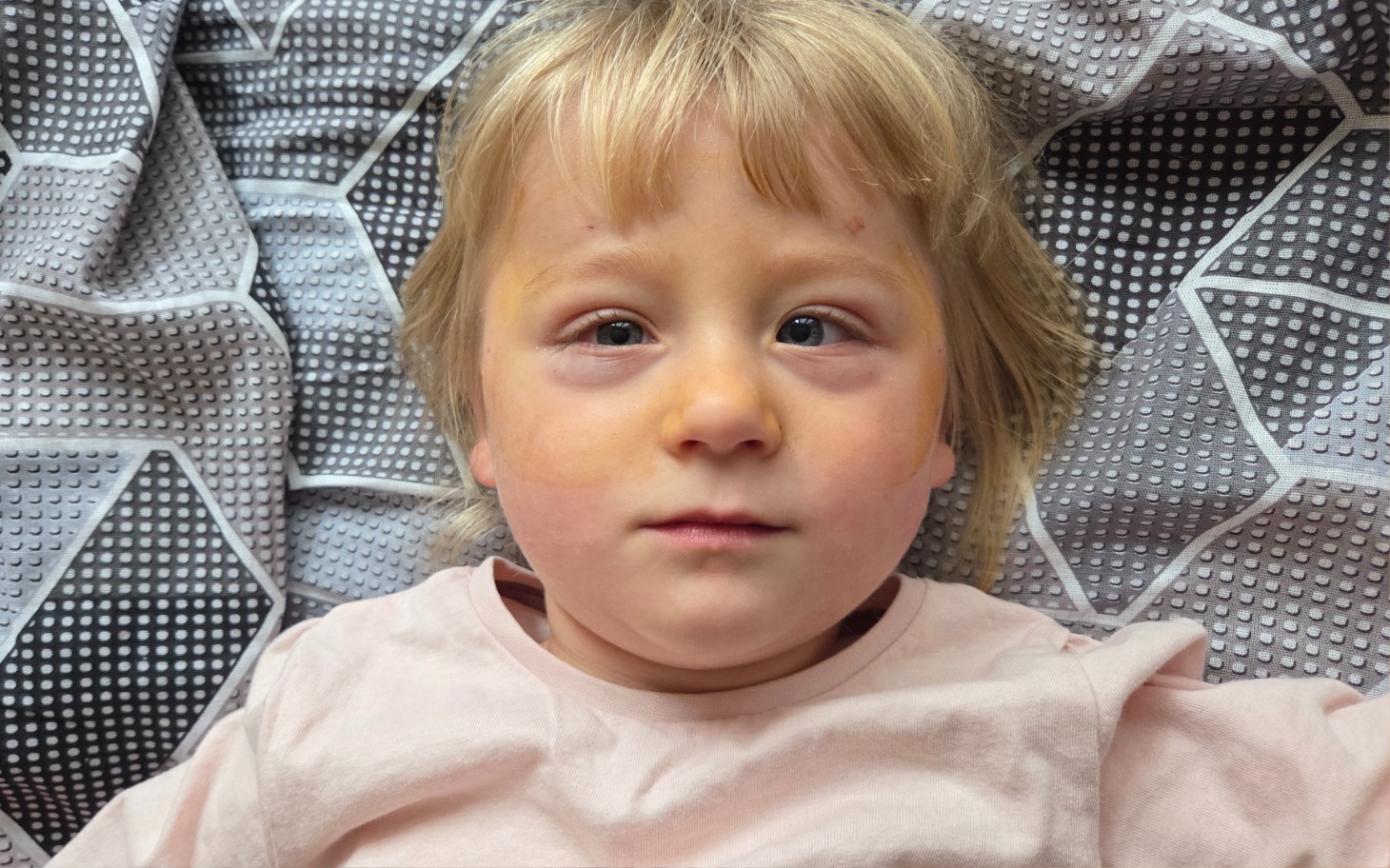 
        Mały chłopiec leżący na łóżku, patrzący w obiektyw.
    