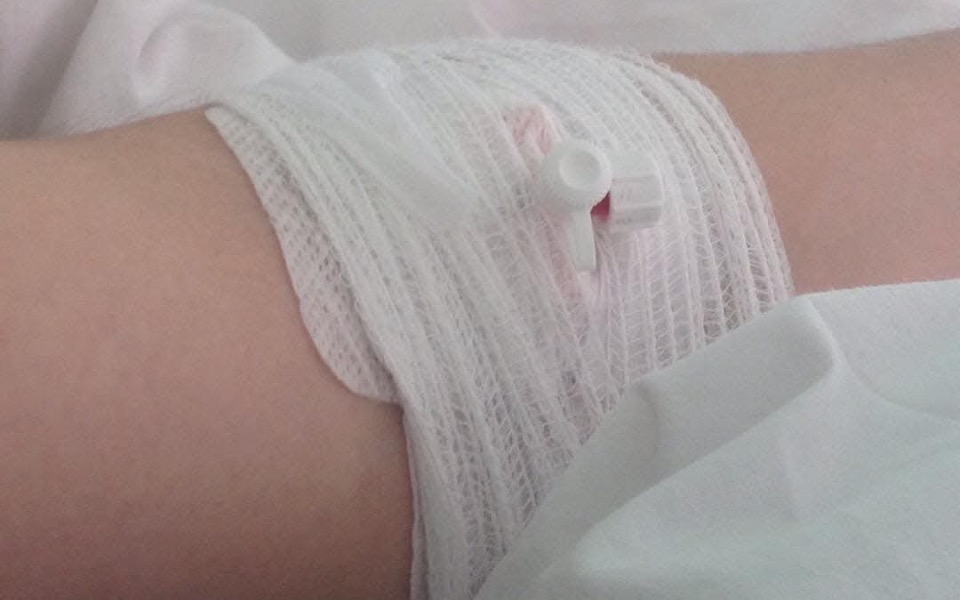 
        Ręka z opatrunkiem, symbolizująca potrzebę wsparcia medycznego.
    