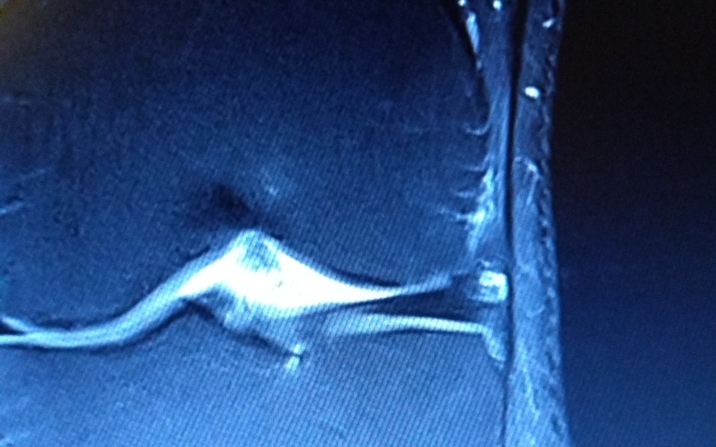 
        Obraz z MRI, przedstawiający szczegóły anatomiczne.
    