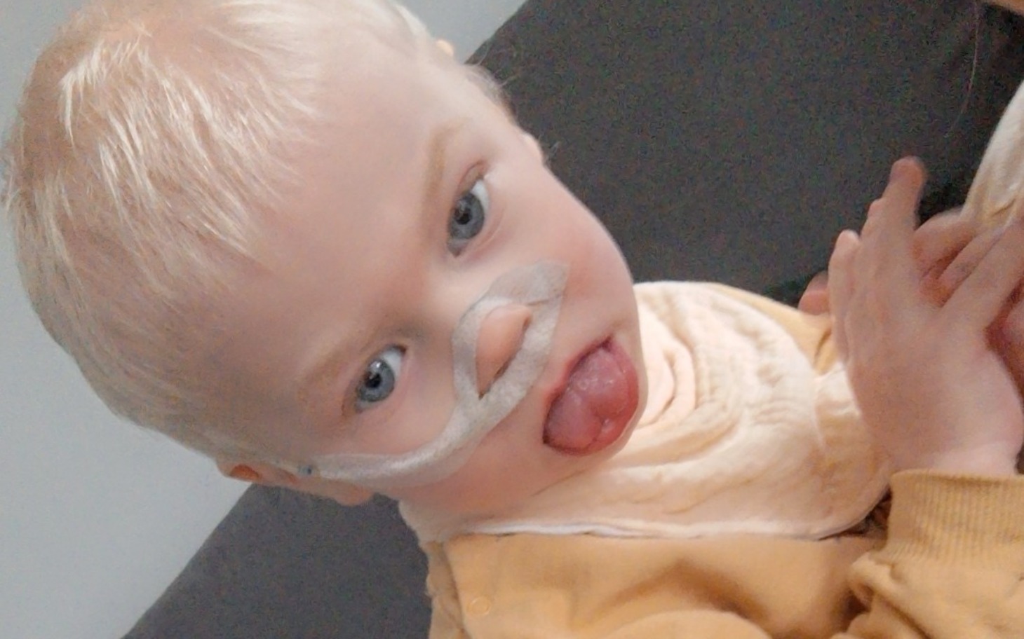 
        Chłopiec z rurką tlenową, uśmiechający się do kamery.
    