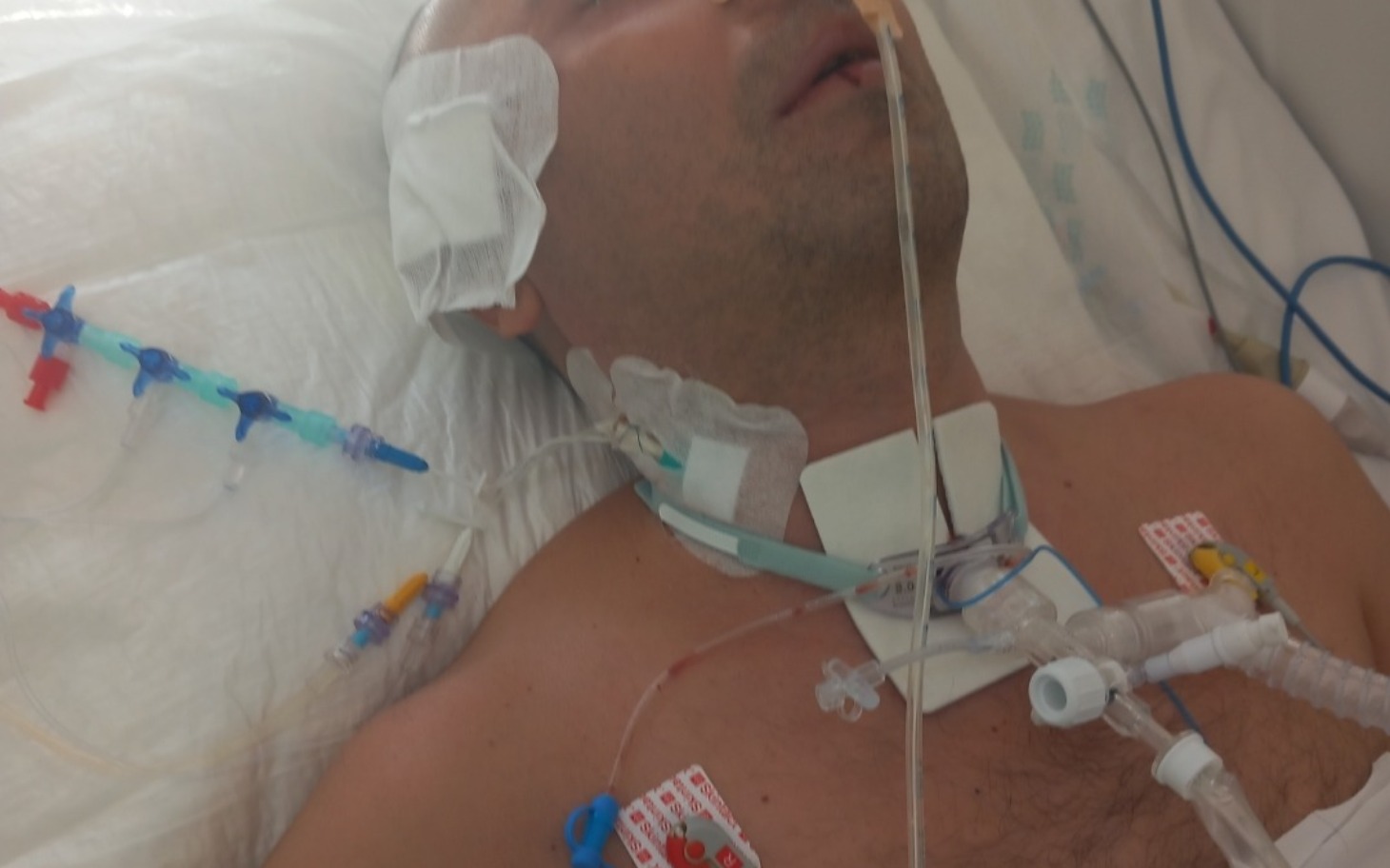 
        Mężczyzna w szpitalu, podłączony do aparatury medycznej.
    