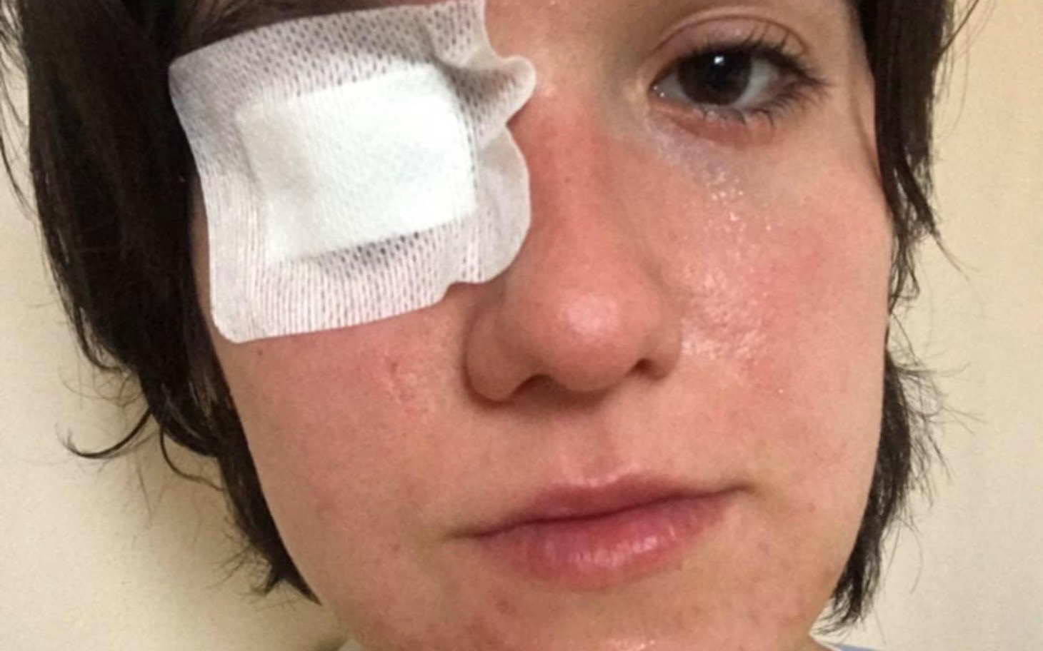 
        Osoba z opatrunkiem na oku, wyrażająca determinację i siłę.
    