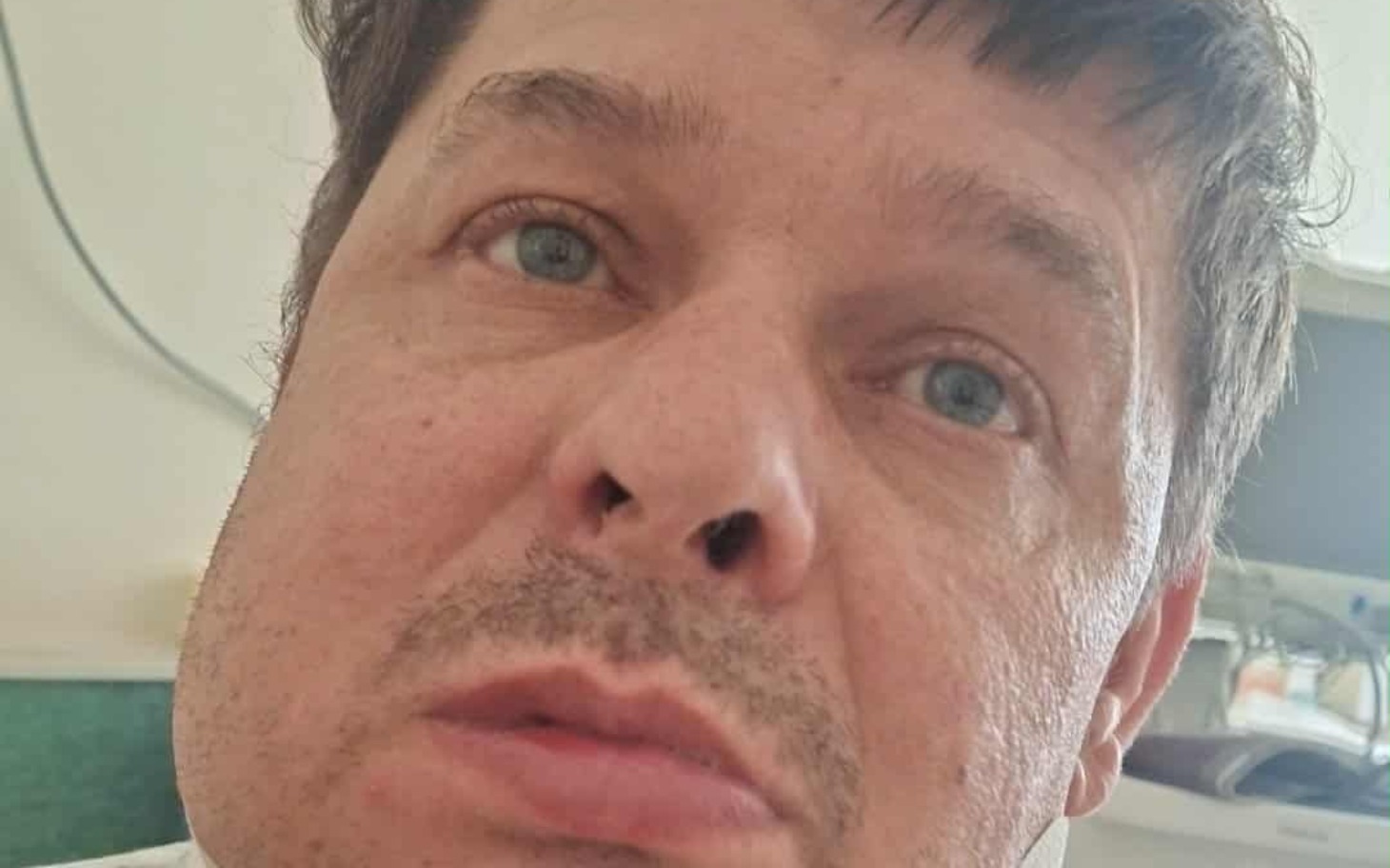 
        Mężczyzna w szpitalu, wygląda na zmartwionego.
    