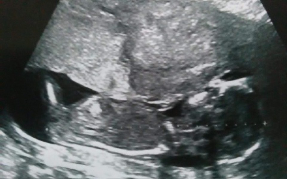 
        Zbiórka Na Rozpoczęcie Rodzicielstwa !! - zdjęcie główne
    