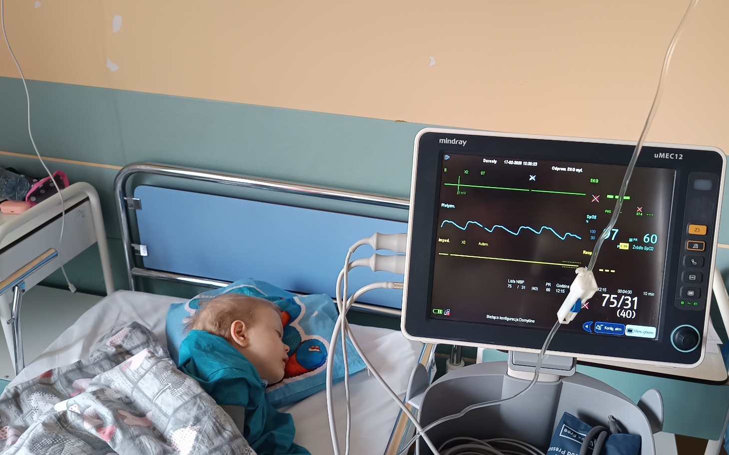 Dziecko w szpitalu z monitorującym urządzeniem medycznym.