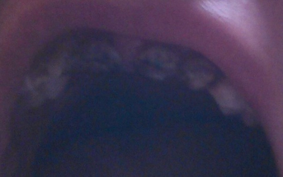 
        Zbiórka Na uśmiech dla Kasi - zdjęcie główne
    