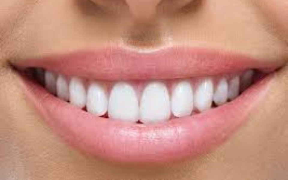 
        Zbiórka wstawienie zebów żonie - zdjęcie główne
    