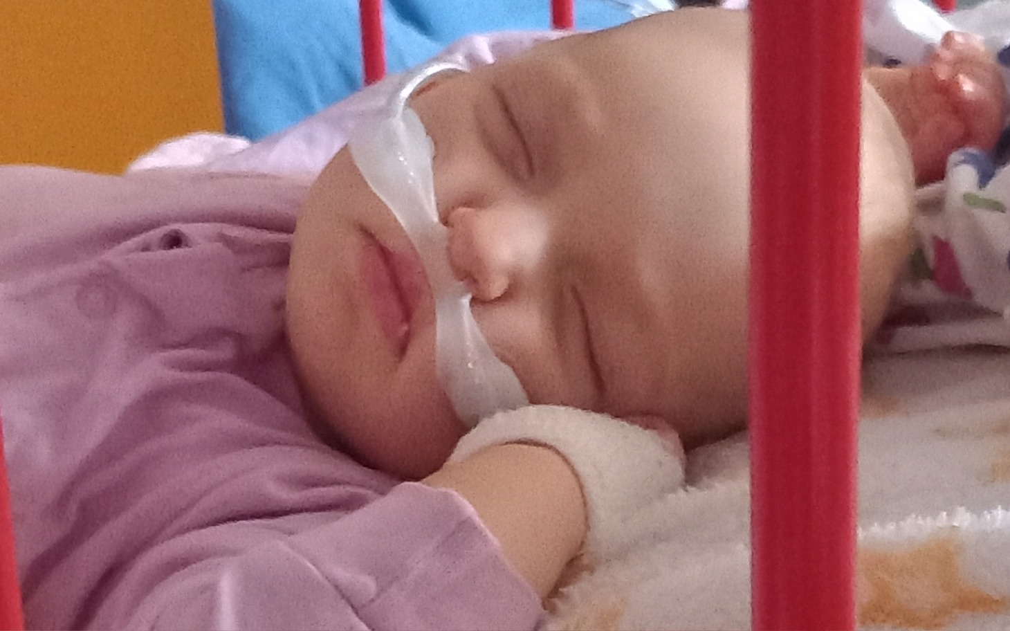 
        Małe dziecko śpiące w szpitalu, z rurką tlenową na twarzy.
    