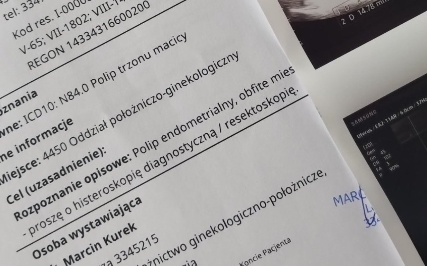 
        Dokument medyczny dotyczący polipa trzonu macicy.
    
